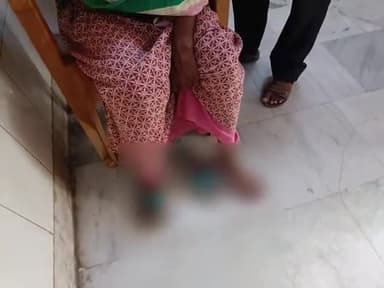 सिमडेगा: बरटोली में महिला को काटा जहरीला सांप, इलाज के लिए लाया गया सिमडेगा सदर अस्पताल