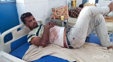 मुरादाबाद: रतनपुर के पास तेज रफ्तार अज्ञात वाहन ने युवक को मारी टक्कर, युवक हुआ गंभीर रूप से घायल