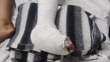 लाडपुरा: मकबरा थाना क्षेत्र के चन्द्रघटा में बाइक सवार युवक ने बालक को मारी टक्कर, बालक घायल