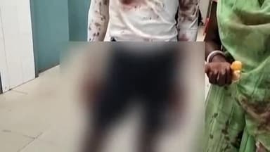 बिहार: सैदी गांव में पूर्व के विवाद को लेकर दो पक्षों में हुई मारपीट, दोनों पक्ष से 3 लोग हुए जख्मी