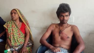 हज़ारीबाग: मंडई खुर्द में मानसिक रूप से विक्षिप्त व्यक्ति के साथ दो अज्ञात लोगों ने की मारपीट