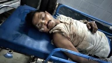 कटिहार: बसतौल के समीप पेड़ से टकराकर बाइक सवार हुआ जख्मी, सदर अस्पताल में कराया गया भर्ती