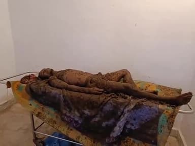 सिमडेगा: फुलवाटांगर में वज्रपात की चपेट में आने से एक व्यक्ति की हुई मौत, परिजनों ने लगाया था गोबर का लेप