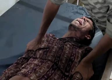 ଝାରବନ୍ଧ: ବିଜୁଳି ବିଭାଗର ଅବହେଳା ପାଇଁ କୋତନା ଠାରେ ବିଦ୍ୟୁତ୍ ସଂସ୍ପର୍ଶରେ ଆସି କର୍ମଚାରୀ ଆହତ