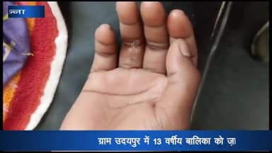 अजयगढ़: ग्राम उदयपुर में 13 वर्षीय बालिका को जहरीले बिच्छू ने डसा, नाजुक हालत में जिला अस्पताल रेफर