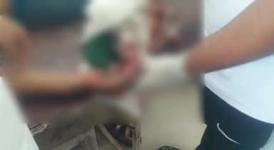 हटा: अंधियारा बगीचा हटा में मिक्सर मशीन की चपेट में आकर मैकेनिक हुआ घायल, इलाज के लिए लाया गया सिविल अस्पताल