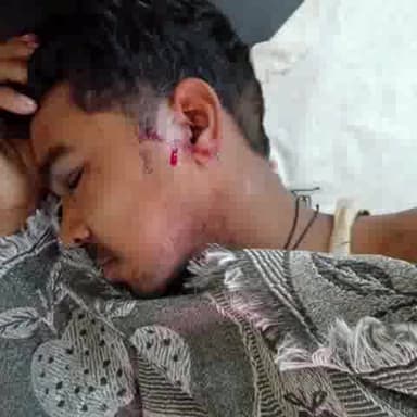 सलोन: भगवतपुर मजरे महानंदपुर गांव में बेड़न की रखवाली कर रहे किसान पर किया गया जानलेवा हमला, पुलिस ने किया मामला दर्ज