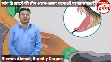 बारिश के बाद सांप के काटने की घटनाएं  बढ़ी, महिला की मौत दो युवक अस्पताल में भर्ती।