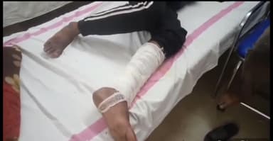 पन्ना: मोहनपुरवा के पास तेज रफ्तार बाइक सवार ने साइकिल सवार अधेड़ को मारी टक्कर, दोनों गंभीर रूप से हुए घायल