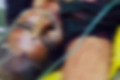 पचोर: उमरिया में गैस सिलेंडर फटने से हमीदिया अस्पताल भोपाल में भर्ती महिला की इलाज के दौरान मौत, पचोर पुलिस ने किया मर्ग कायम