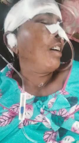 यूपी बलरामपुर में ललिया थाना क्षेत्र के बसंत पुर गांव में घास काटने गई अधेड़ महिला को अज्ञात लोगों ने हमला कर घायल किया।