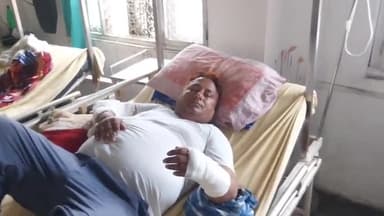 रामपुर: थाना बिलासपुर के बाईपास चौराहे पर बाइक सवार दंपत्ति के सामने आवारा पशु आने से बाइक अनियंत्रित होकर गिरी, 2 लोग घायल