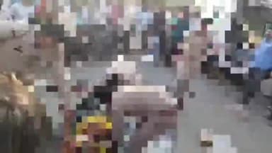 करछना: महुआरी गांव के पास तेज रफ्तार DCM ट्रक की टक्कर से बाइक सवार भाई-बहन हुए घायल, पुलिस ने घायलों को पहुंचाया अस्पताल