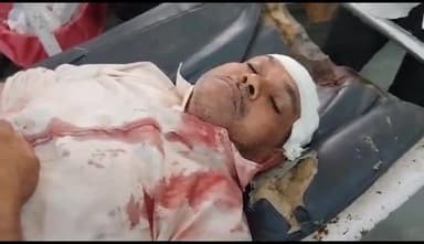 अलवर: राठी मार्केट के समीप जमीनी रंजिश के चलते एक व्यक्ति को कुछ लोगों में फर्सी व कुल्हाड़ी से मारपीट कर किया घायल