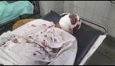 अलवर: कांदोली बाईपास पर जीप व बाइक की भिड़ंत में बाइक सवार व्यक्ति हुआ घायल, जिला अस्पताल में उपचार जारी