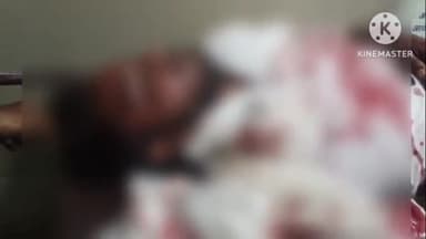 लाडपुरा: कोटा कैथून मार्ग पर सड़क हादसे में बाइक सवार 2 युवक गंभीर रूप से घायल