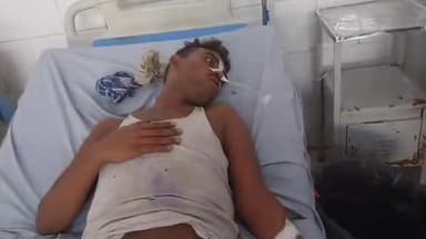 मुरादाबाद: जयंतीपुर में पत्नी से विवाद के चलते युवक ने पिया जहरीला पदार्थ, हालत बिगड़ने पर अस्पताल में कराया गया भर्ती