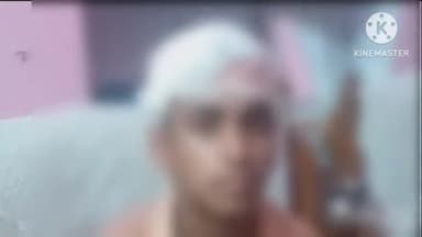 लाडपुरा: शहर के रामपुरा महात्मा गांधी स्कूल में क्लास में चलता पंखा छात्र पर,गिरा सिर पर आए 5 टांके