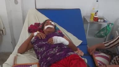 मुरादाबाद: मिलक के पुल पर ऑटो ने महिला को पीछे से मारी ठोकर, महिला गंभीर रूप से हुई घायल