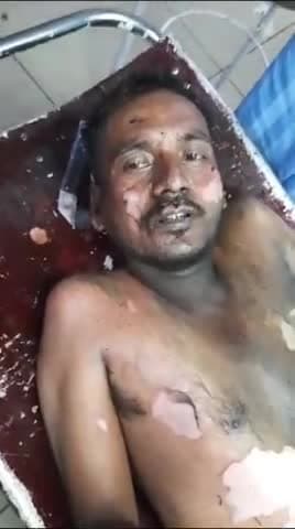 ब्रेकिंग न्यूज़ कानपुर थाने के सामने युवक ने लगाई आग।