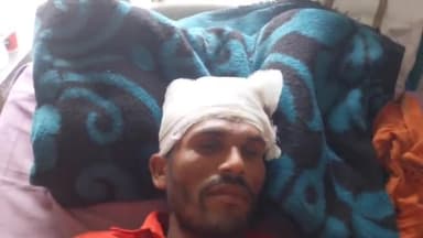 रामपुर: अजीम नगर थाना क्षेत्र के ग्राम खामोतियां बख़्ती में बाइक और एरो ट्रैक्टर की टक्कर में बाइक सवार एक व्यक्ति हुआ घायल