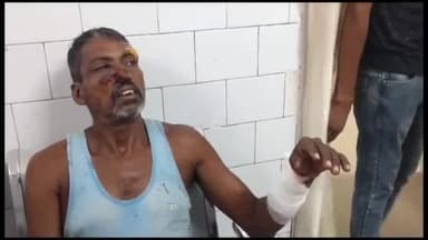 गिरिडीह: बिरनी के भरकट्टा में सावन गोप को आवारा कुत्तों ने काट कर दिया घायल,सदर अस्पताल में चल रहा है इलाज।