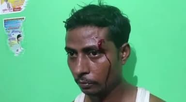 सवायजपुर: पाली में दबंगों ने घर में घुसकर युवक पर किया जानलेवा हमला, पुलिस पर पीड़ित पक्ष के 2 लोगों को हिरासत में रखने का आरोप