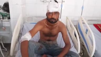 मुरादाबाद: प्रभात मार्केट पर सड़क पार करते समय कार ने युवक को मारी टक्कर, युवक हुआ घायल