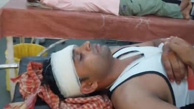 रामपुर: कोतवाली क्षेत्र के जौहर यूनिवर्सिटी के पास अचानक कुत्ता आ जाने से अनियंत्रित होकर गिरी स्कूटी, चालक हुआ घायल