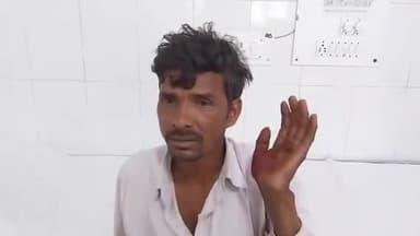 मुरादाबाद: मनोहरपुर में लेबर लेने जा रहे व्यक्ति को अज्ञात कारणों से आरोपी ने मारपीट कर किया घायल