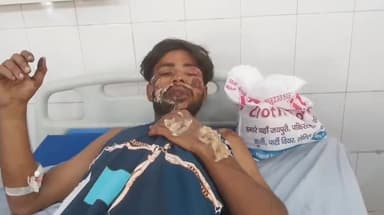 मुरादाबाद: दिल्ली रोड के साई हॉस्पिटल के सामने तेज रफ्तार कार ने स्कूटी में मारी टक्कर, एक युवक गंभीर रूप से हुआ घायल