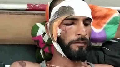 हिसार: मिर्जापुर रोड पर गाड़ी ने बाइक को मारी टक्कर, बाइक सवार का अस्पताल में इलाज जारी