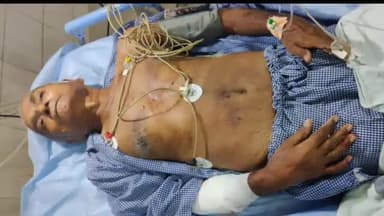 फुलवारी: परसा बाजार थाना क्षेत्र में निसंतान चाचा को भतीजे ने मारी गोली, गंभीर अवस्था में एम्स में एडमिट