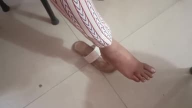 हाथरस: श्यामकुंज कालोनी में एक युवती को आवारा कुत्ते ने काटकर किया घायल, युवती को कराया गया जिला अस्पताल में भर्ती उपचार जारी,