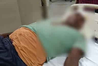 बहराइच: टिकोरा इलाके में पत्नी को मायके छोड़ने गए पति के साथ विपक्षी ने की मारपीट, अस्पताल में उपचार जारी