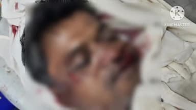 आगर: आगर-बडोद मार्ग पर मदकोटा के समीप दो बाइक में आमने-सामने हुई भिड़ंत, एक व्यक्ति की हुई मौत व दो लोग हुए घायल