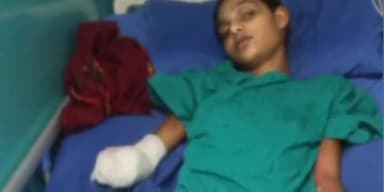 पचोर: पचोर में हाई टेंशन बिजली के करंट से झुलसी बालिका के उपचार के लिए आगे आए समाजसेवी अभियान चलाकर उपचार के लिए जुटाए पैसे