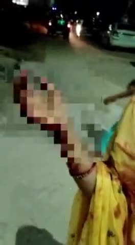 गाज़ियाबाद: खोड़ा में 1 बच्चे सहित दो लोगों पर तलवार से हमला करने का आरोप लगाते हुए वीडियो सोशल मीडिया पर हुआ वायरल