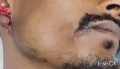 અસારવા: કૃષ્ણનગરમાં બે પક્ષ વચ્ચે મારામારીમાં એક યુવકનો કાન કપાયો, પોલીસે સામસામે બંને પક્ષ વિરુદ્ધ નોંધી ફરિયાદ