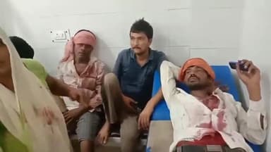 मुरादाबाद: कटघर थाना क्षेत्र में चुनावी रंजिश को लेकर दो पक्षों में हुई जमकर मारपीट, एक पक्ष की ओर से आधा दर्जन से अधिक हुए घायल