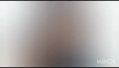 गोगरी: उसरी गांव में खाना बनाते समय दबंगों ने गर्म पानी फेंक कर महिला को किया घायल, उपचार जारी