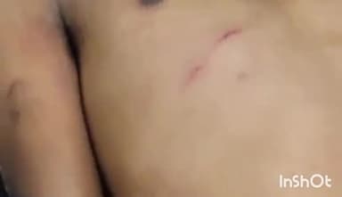 અસારવા: કૃષ્ણનગરમાં પાડોશીઓ વચ્ચે થયેલી મારામારીમાં પોલીસે આરોપીની કરી ધરપકડ