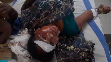 मधेपुरा: सिंहेश्वर से पीछे डोमा चौक के समीप बाइक अनियंत्रित होने से बाइक पर सवार 1 महिला सड़क दुर्घटना जख्मी मेडिकल कॉलेज अस्पताल