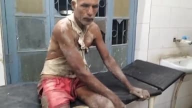 साहेबगंज: मकड़ी टोला में जमीनी विवाद में जमकर चली लाठियां, बाप व बेटी को कुछ लोगों ने गंभीर रूप से किया घायल