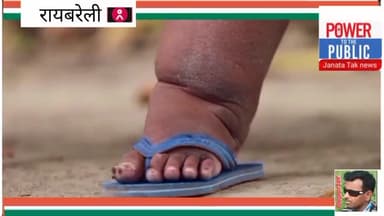 10 अगस्त जनपद रायबरेली में स्वास्थ्य विभाग द्वारा एमडीए अभियान चलाया जा रहा है।