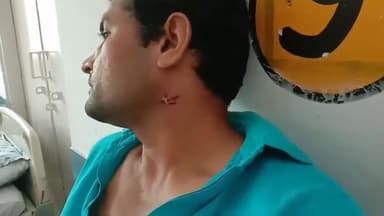 मुरादाबाद: भोजपुर थाना क्षेत्र में बच्ची के बहाने से पिता को बुलाकर साले और ससुर ने की मारपीट, घायल को अस्पताल में भर्ती कराया