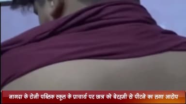 खाचरौद: रोनी पब्लिक स्कूल के प्राचार्य पर छात्र को बेरहमी से पीटने का लगा आरोप, शिक्षा अधिकारी ने मामले की जांच शुरू की
