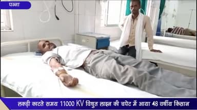 अजयगढ़: ग्राम देवरा भापतपुर में लकड़ी काटते समय 11000 KV विद्युत लाइन की चपेट में आने से किसान हुआ गंभीर रूप से घायल