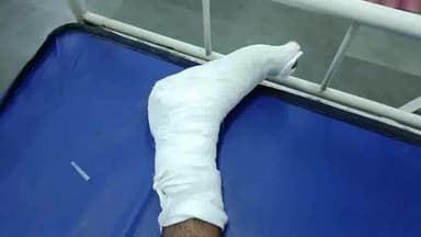 गौरिहार: नाहरपुर के पास बाइक पर सवार देवर-भाभी ट्रैक्टर का पहिया लगने से हुए घायल, उपचार के लिए भेजा गया जिला अस्पताल