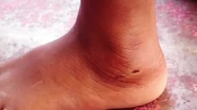 ಮುಂಡರಗಿ: ಪಟ್ಟಣದಲ್ಲಿ ಆಟವಾಡುತ್ತಿದ್ದ ಮಗು ಮೇಲೆ ಬೀದಿ ನಾಯಿ ದಾಳಿ